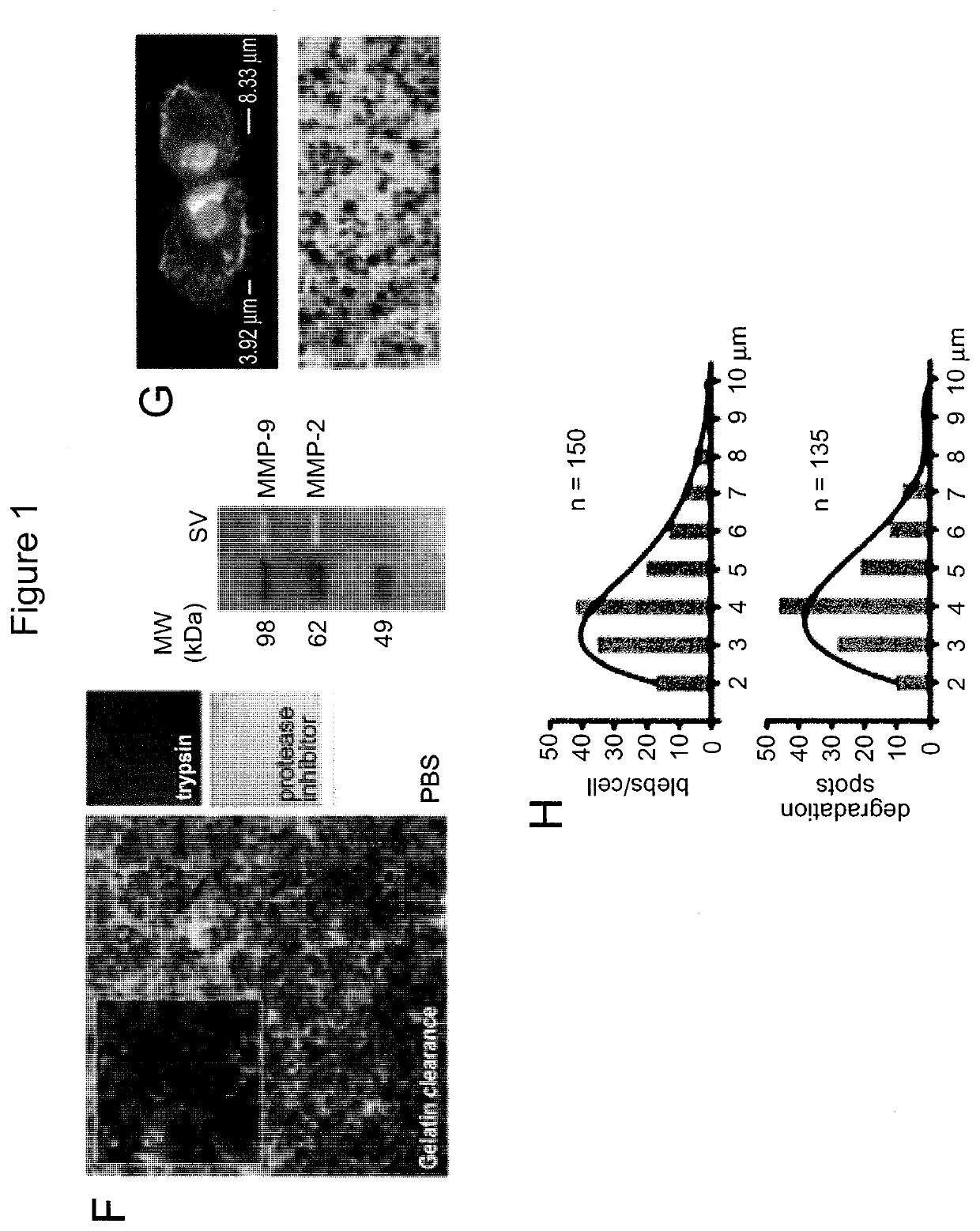 Palmitoyl Protein Biomarkers in Purified Extracellular Vesicles for Early Identification of Clinically Significant Prostate Cancer