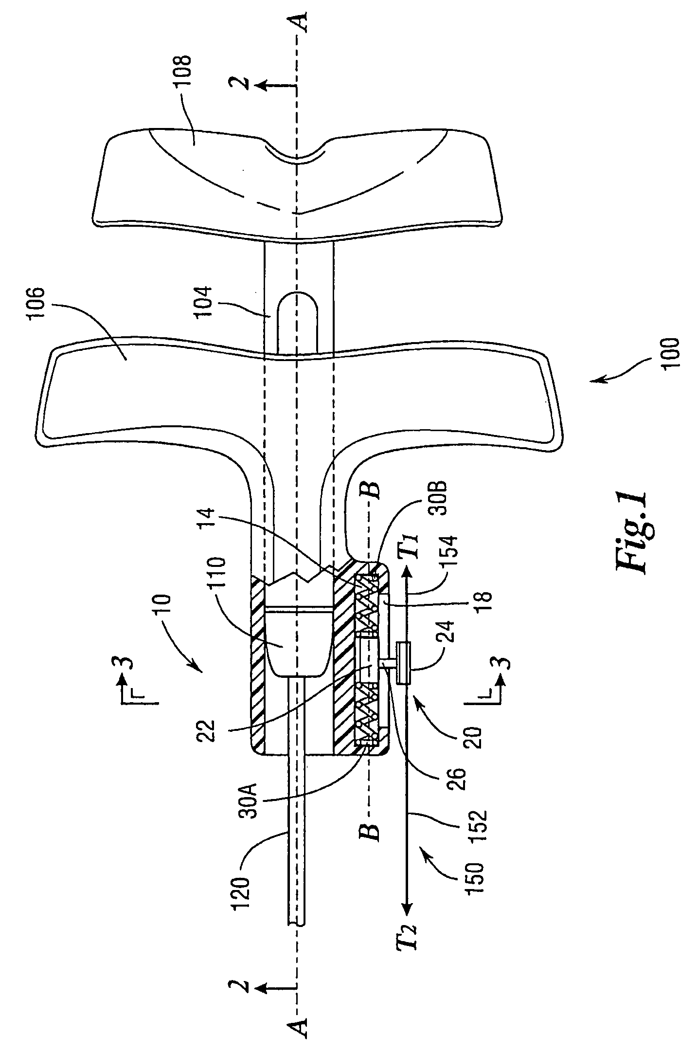 Endoscopic suturing tension controlling and indication devices