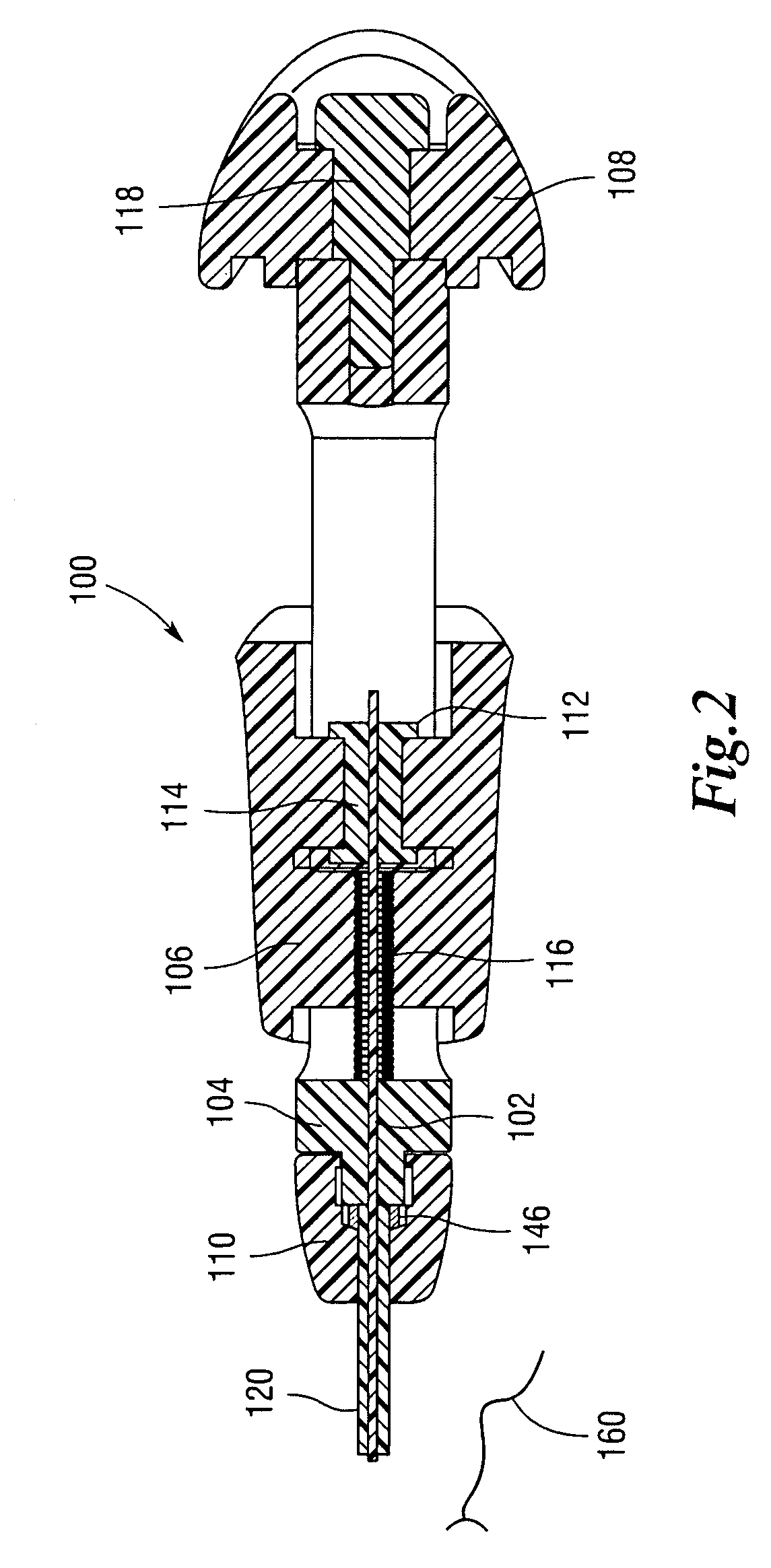 Endoscopic suturing tension controlling and indication devices