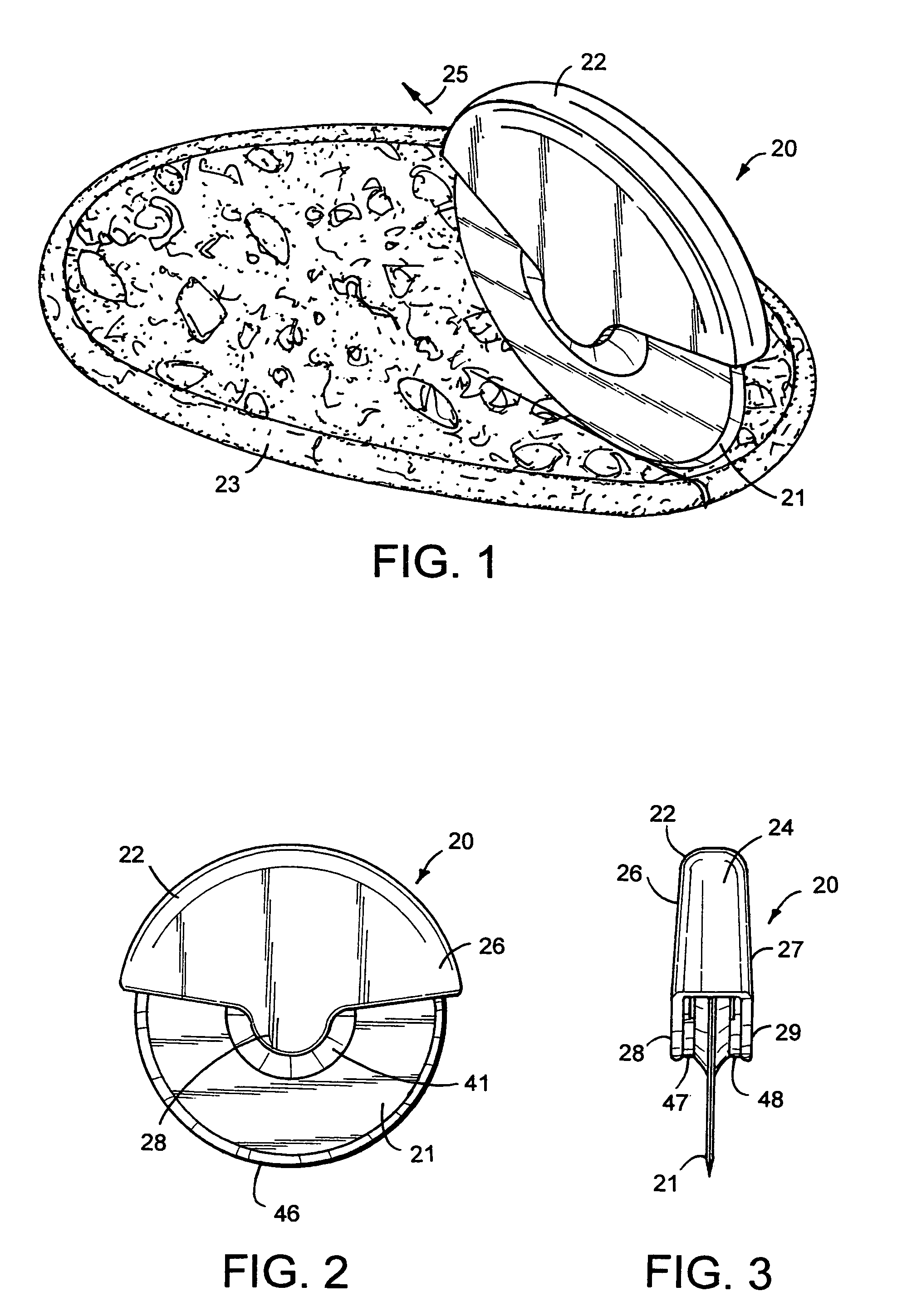 Disc cutter