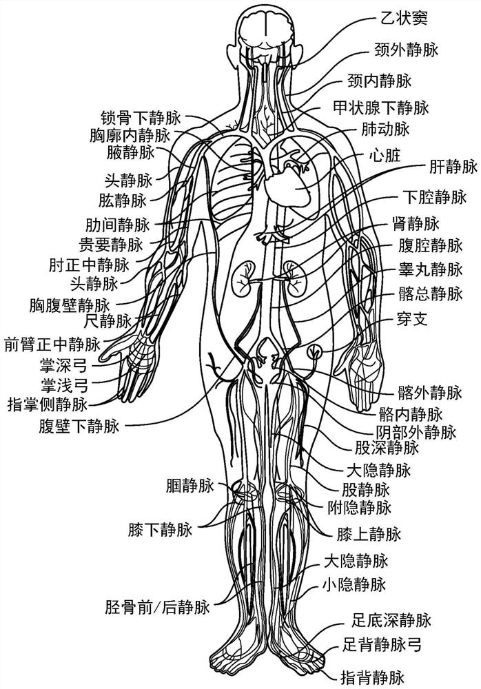 Disease specific and treatment type specific control of intraluminal ultrasound imaging