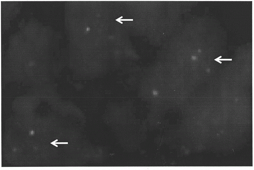 Application of gene probes and kits for alveolar soft tissue sarcoma