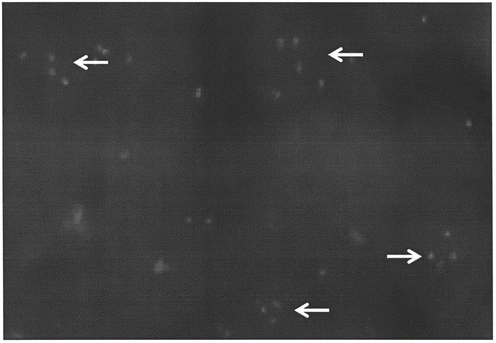 Application of gene probes and kits for alveolar soft tissue sarcoma