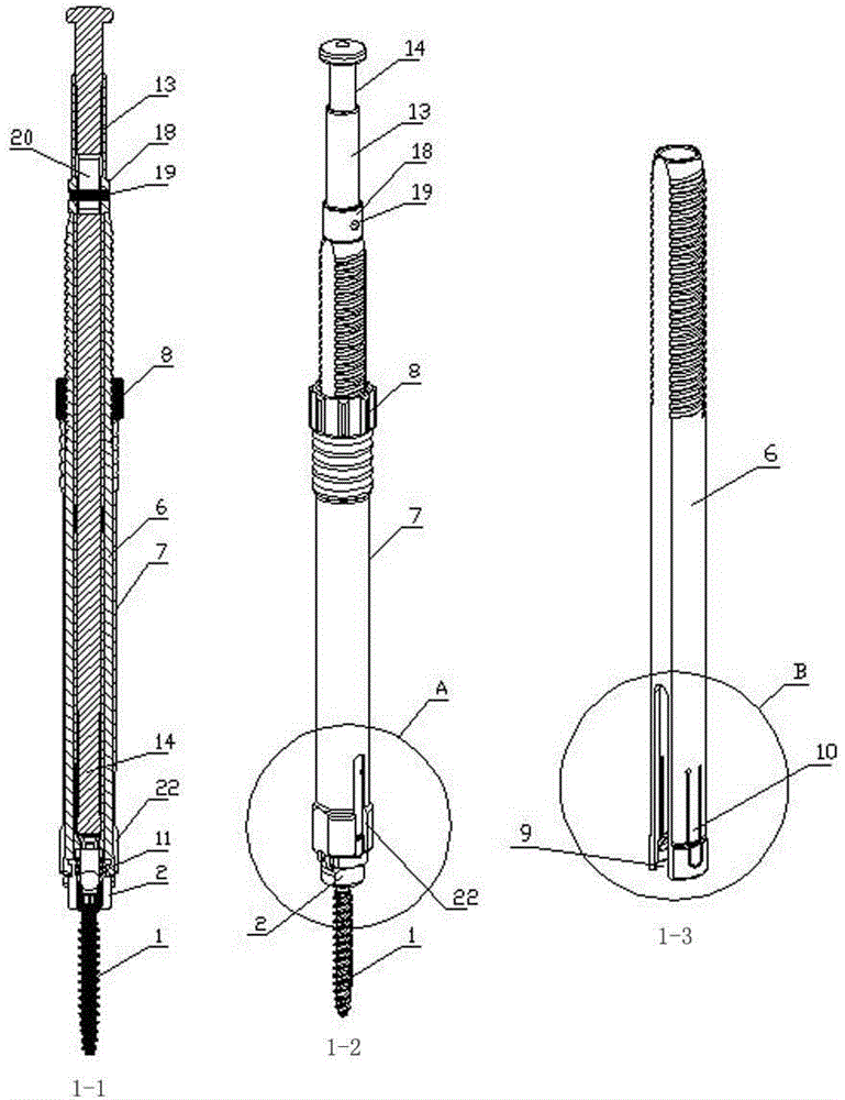 Pedicle screw and bar pressing device