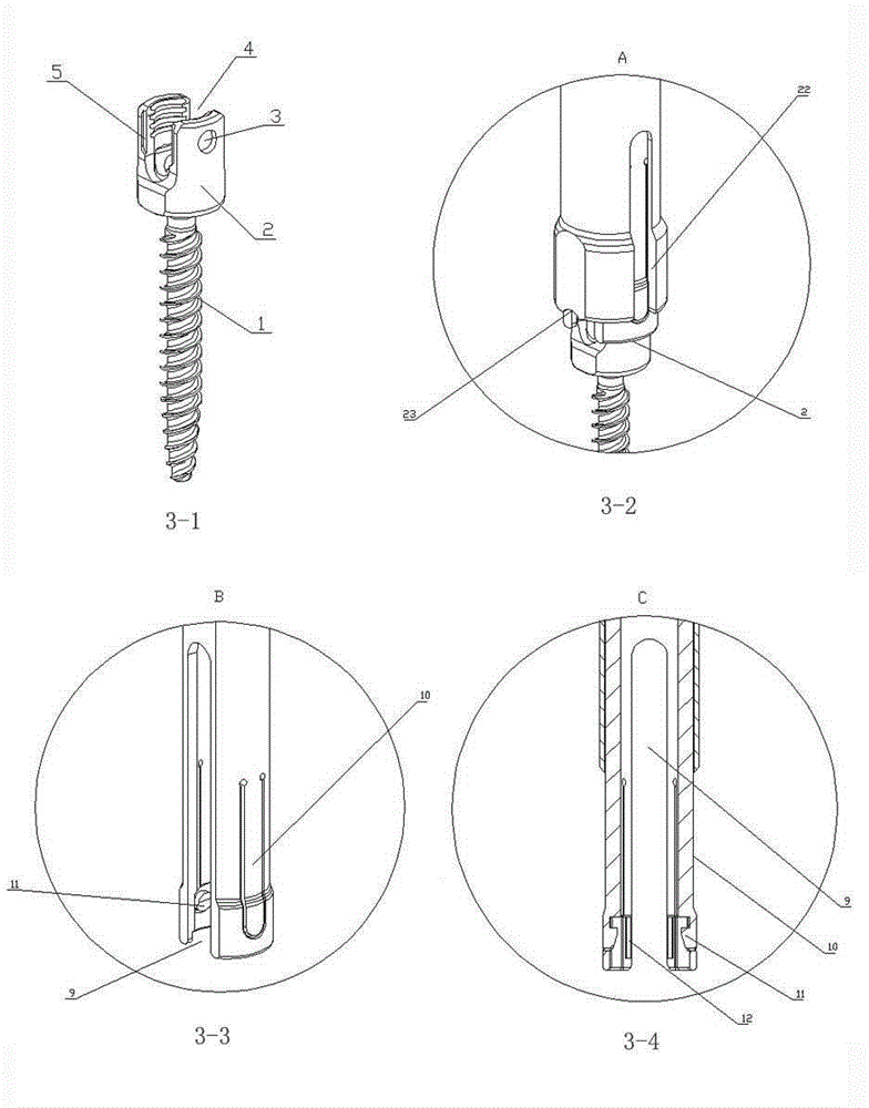 Pedicle screw and bar pressing device