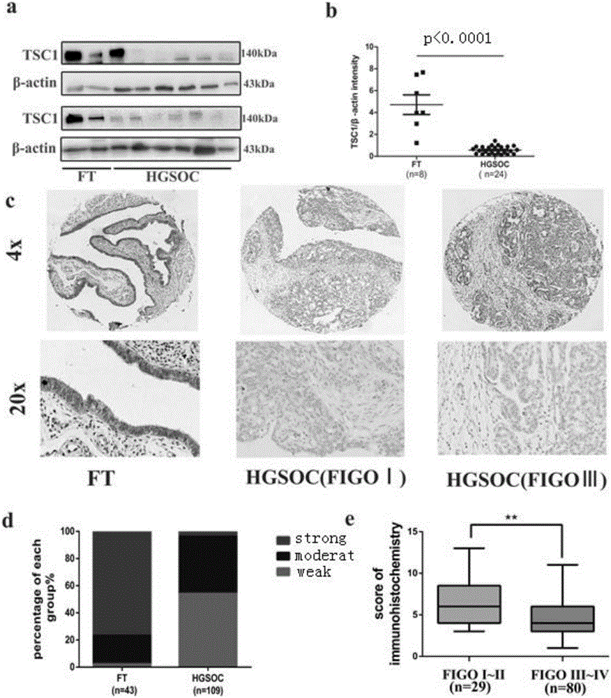 Application of miR-130a to diagnosis, treatment and prognosis of ovarian cancer