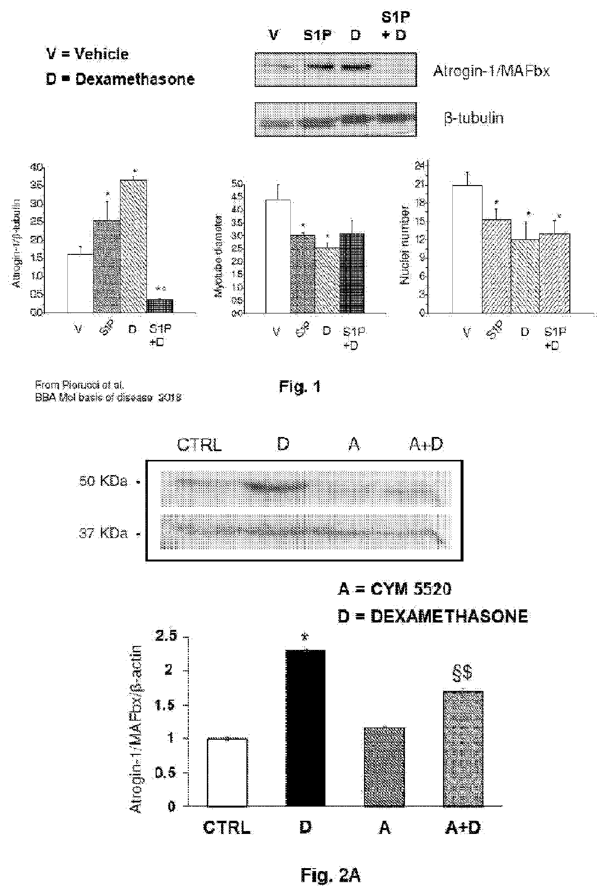 A pharmaceutical composition of s1pr modulators