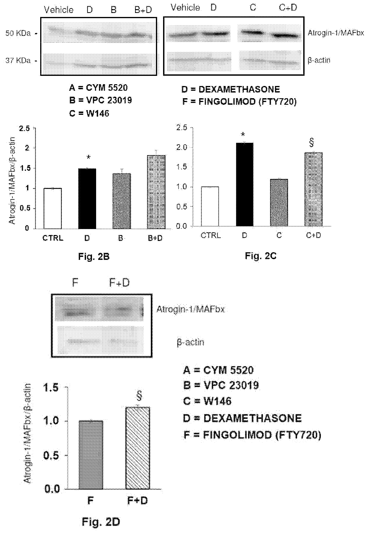 A pharmaceutical composition of s1pr modulators