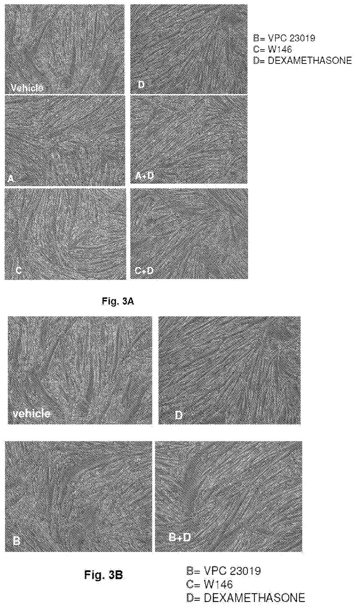 A pharmaceutical composition of s1pr modulators