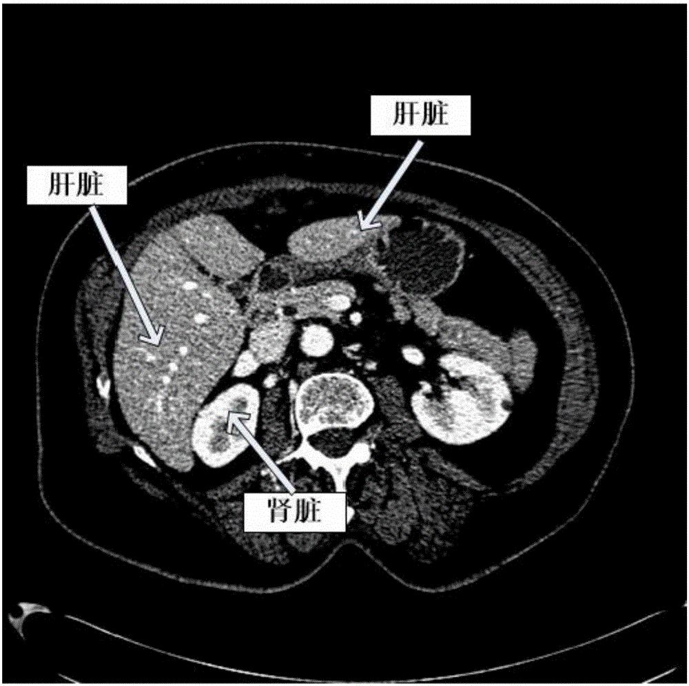 Fully-automatic three-dimensional liver segmentation method based on local apriori information and convex optimization