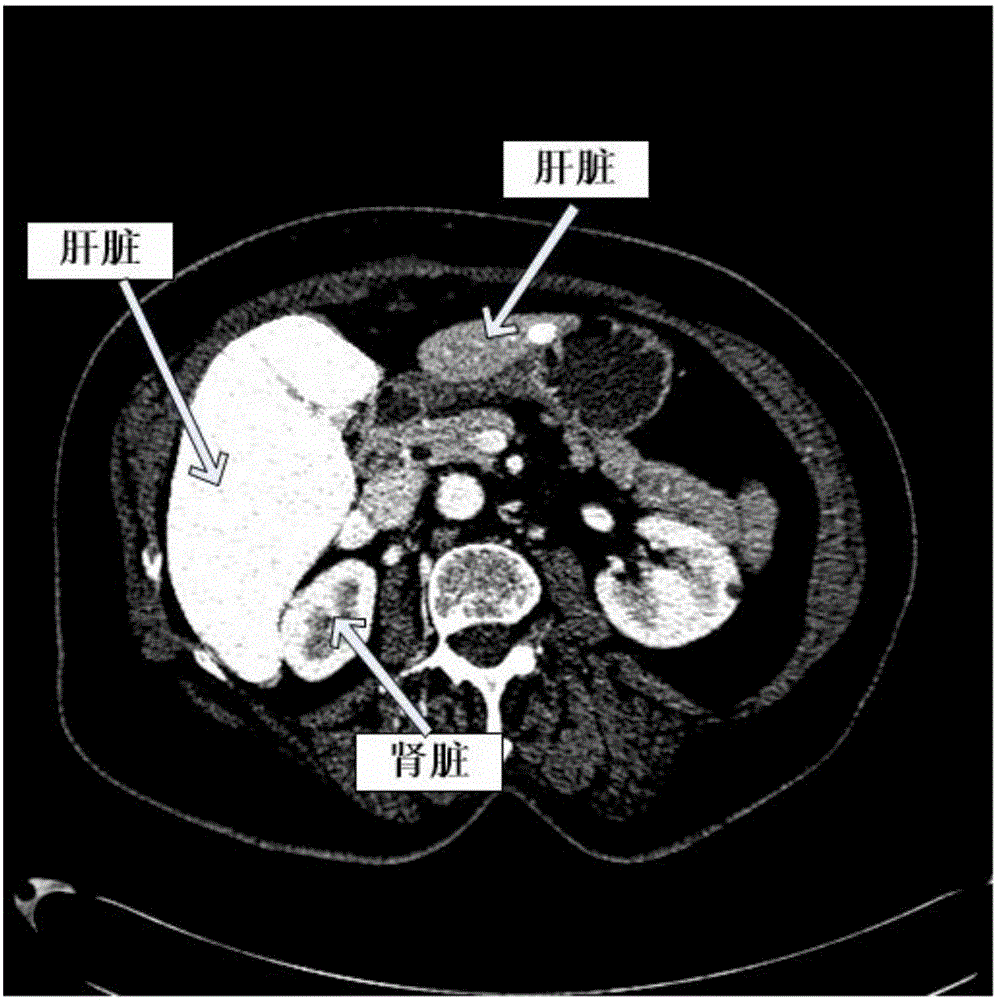 Fully-automatic three-dimensional liver segmentation method based on local apriori information and convex optimization