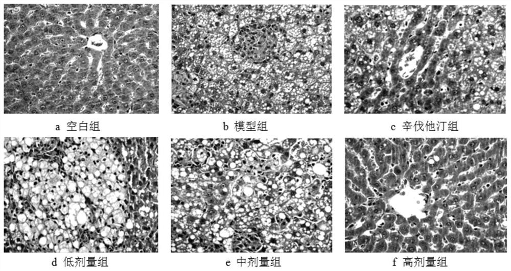 Application of jelly jelly extract in the preparation of drugs or health products for regulating intestinal flora