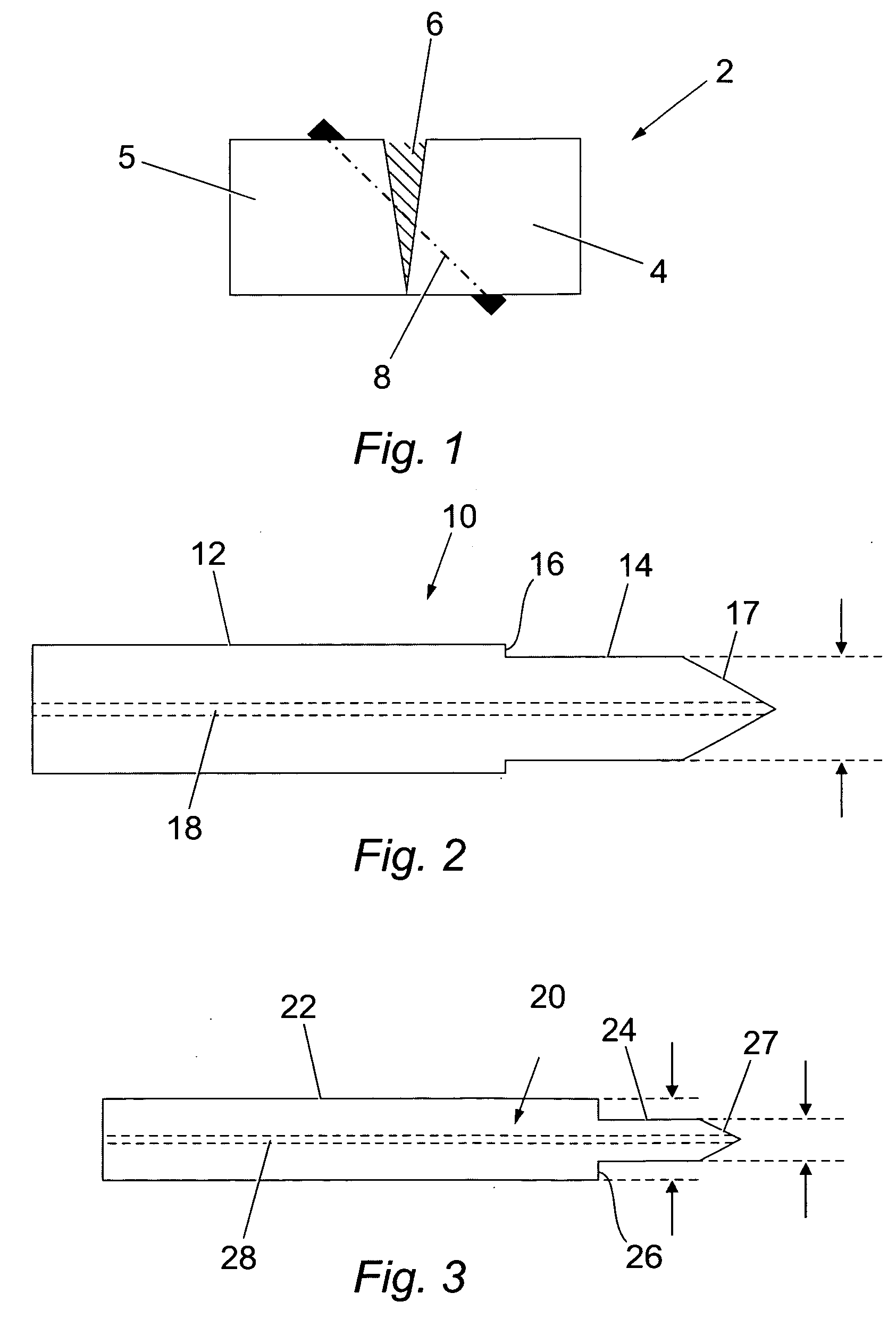 Method of bone surgery