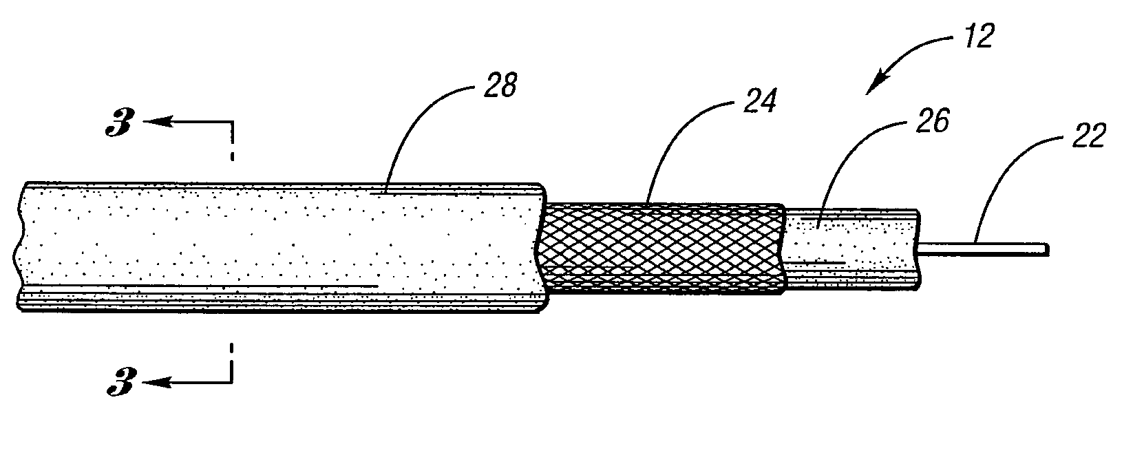 Anti-entrapment system