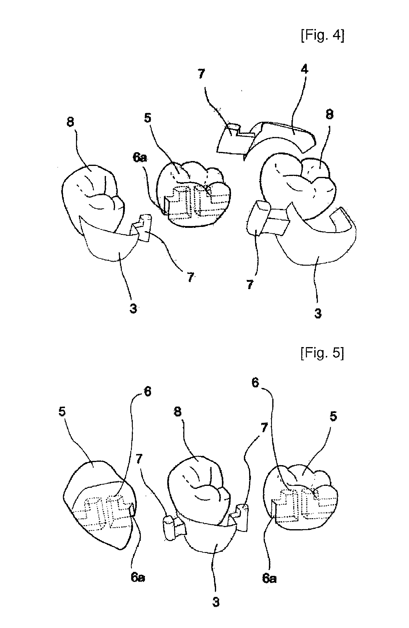 Dental prosthesis and its manufacturing method