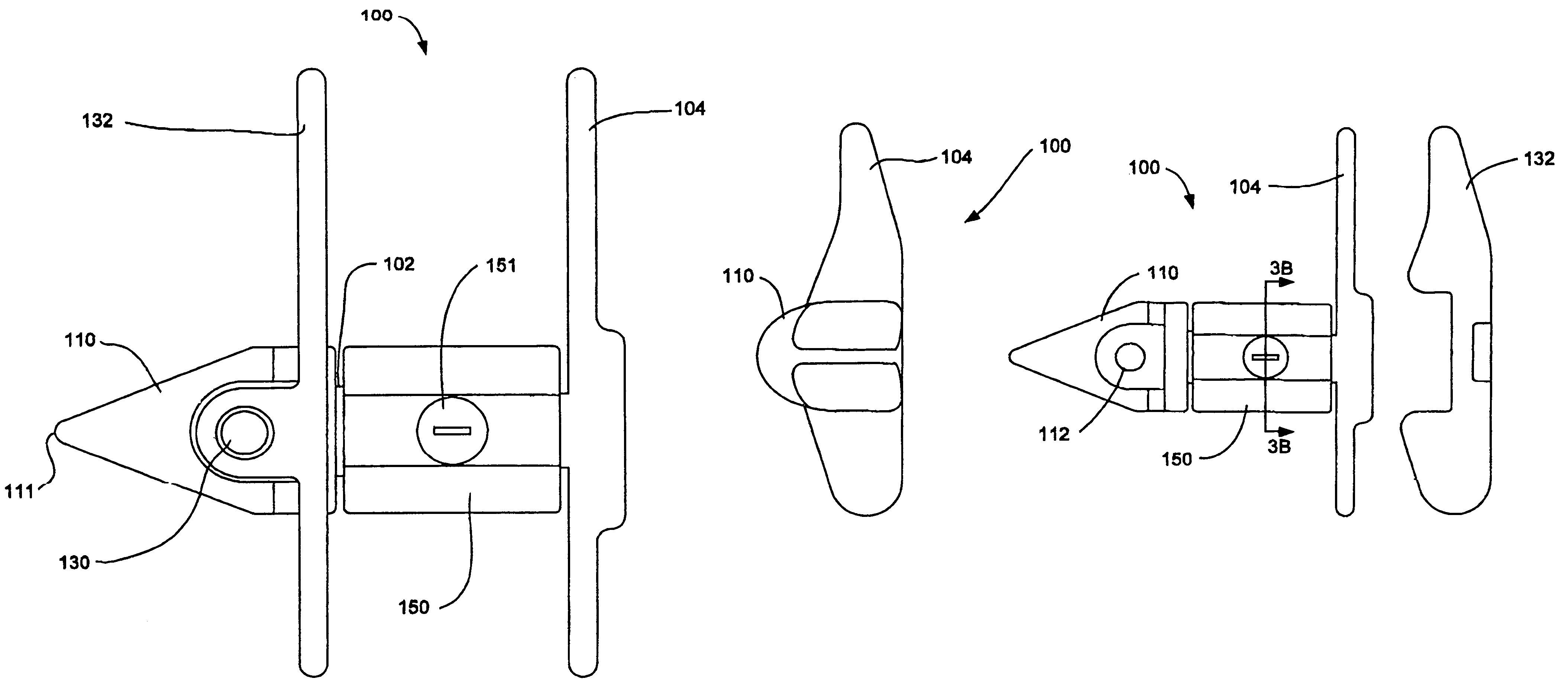 Interspinous process apparatus and method with a selectably expandable spacer