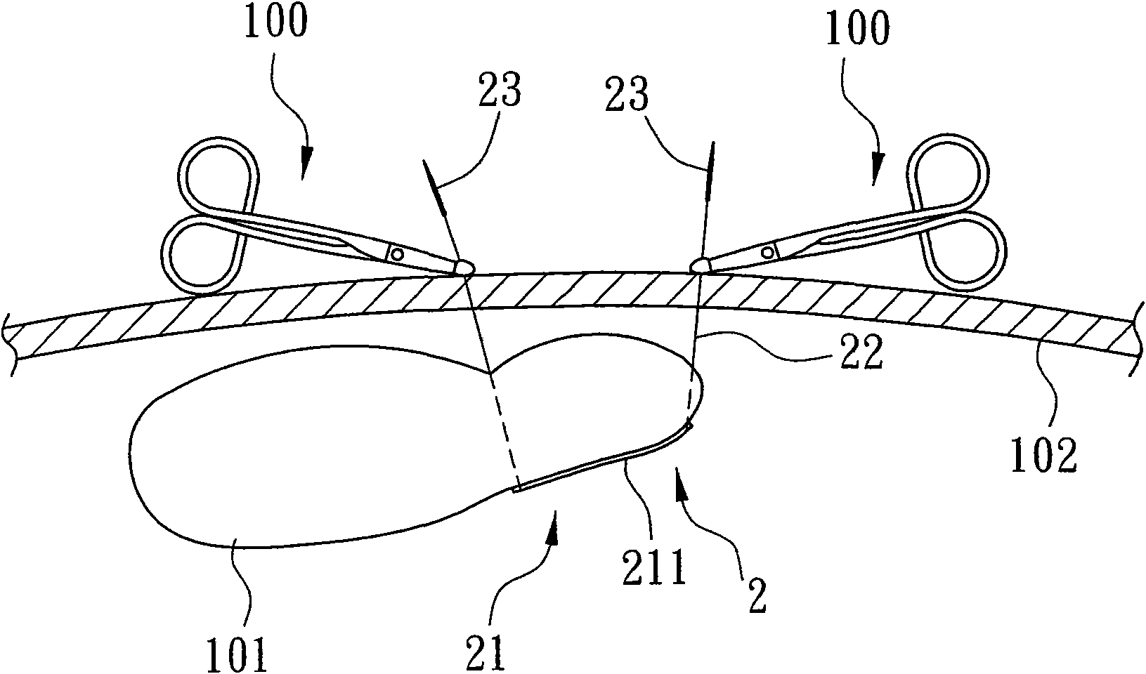 Intra-abdominal organ suspension device