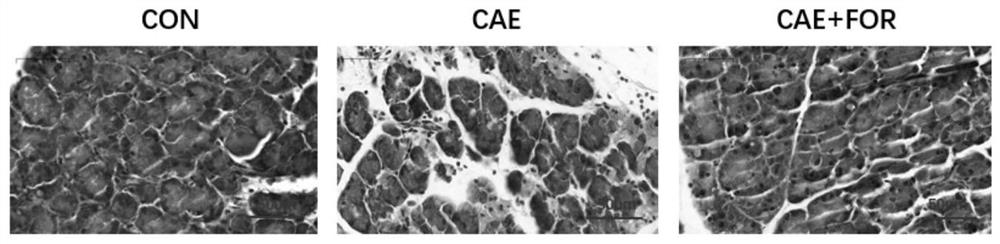 Application of formononetin in preparation of medicine for preventing and treating acute pancreatitis diseases