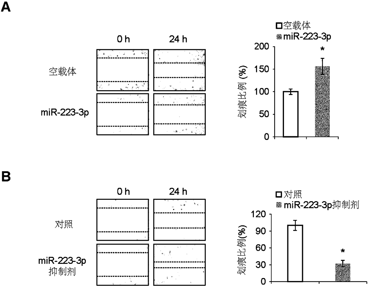 MiR-223-3p for inhibiting growth and transfer of osteosarcoma