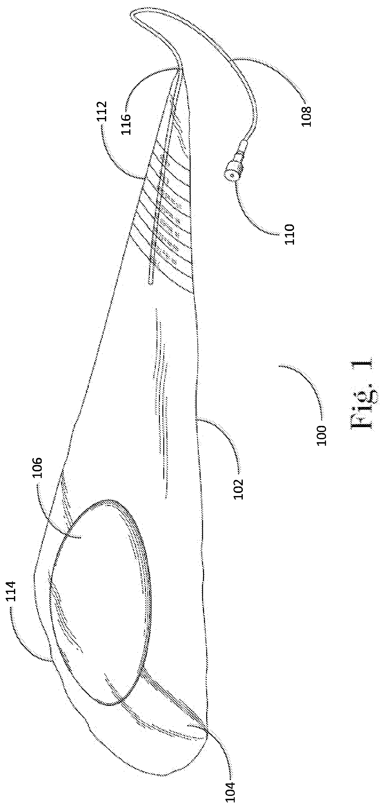 Closed funnel for the delivery of a prosthetic implant