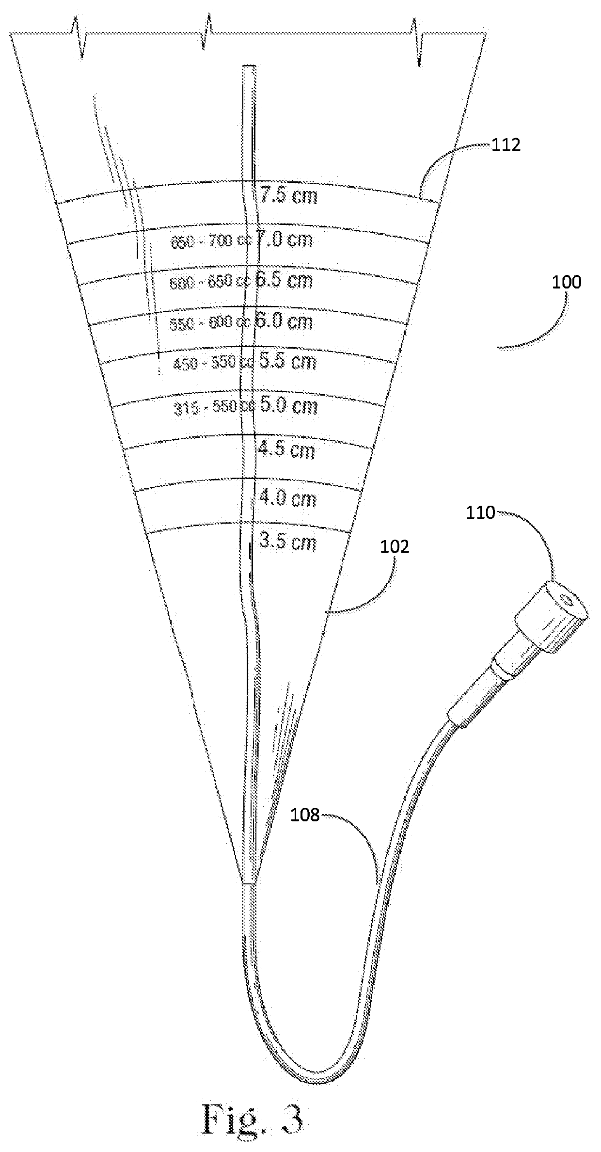 Closed funnel for the delivery of a prosthetic implant