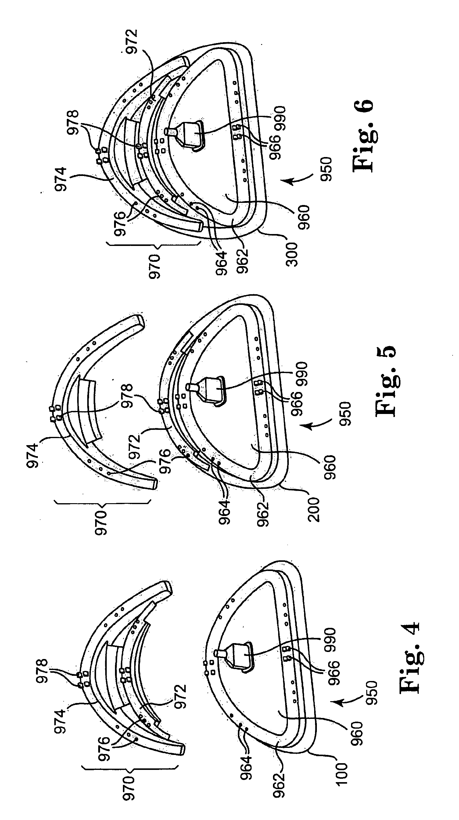 Holder Devices for Annuloplasty Devices Having a Plurality of Anterior-Posterior Ratios