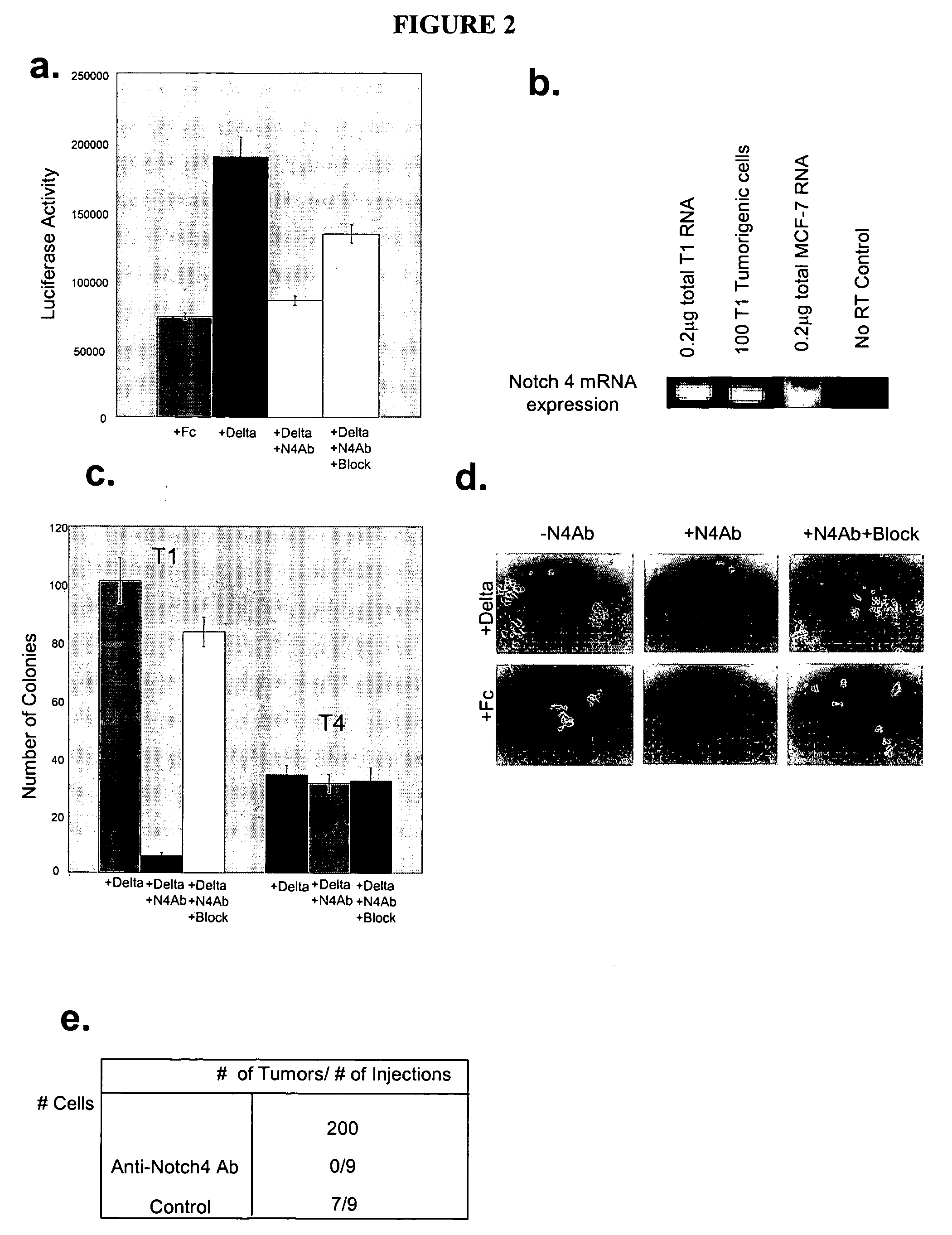 Compositions and methods for characterizing, regulating, diagnosing, and treating cancer