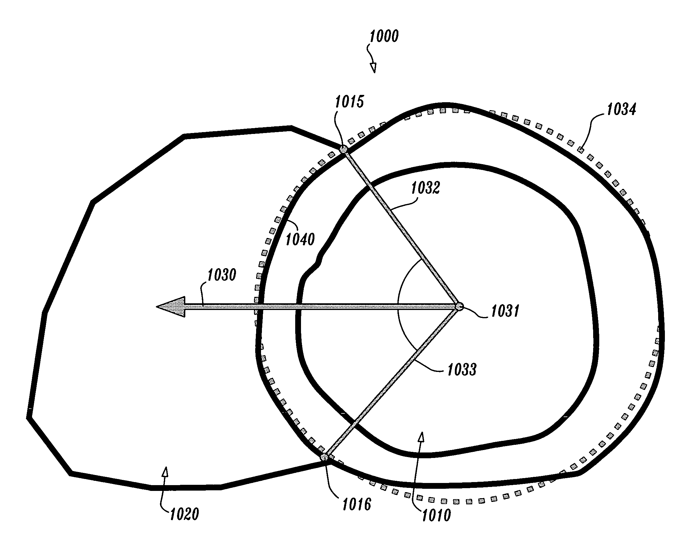 Automatic optimal view determination for cardiac acquisitions