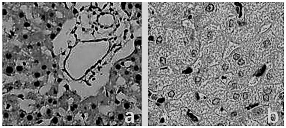 A normothermic mechanical perfusate that can expand the source of donor liver