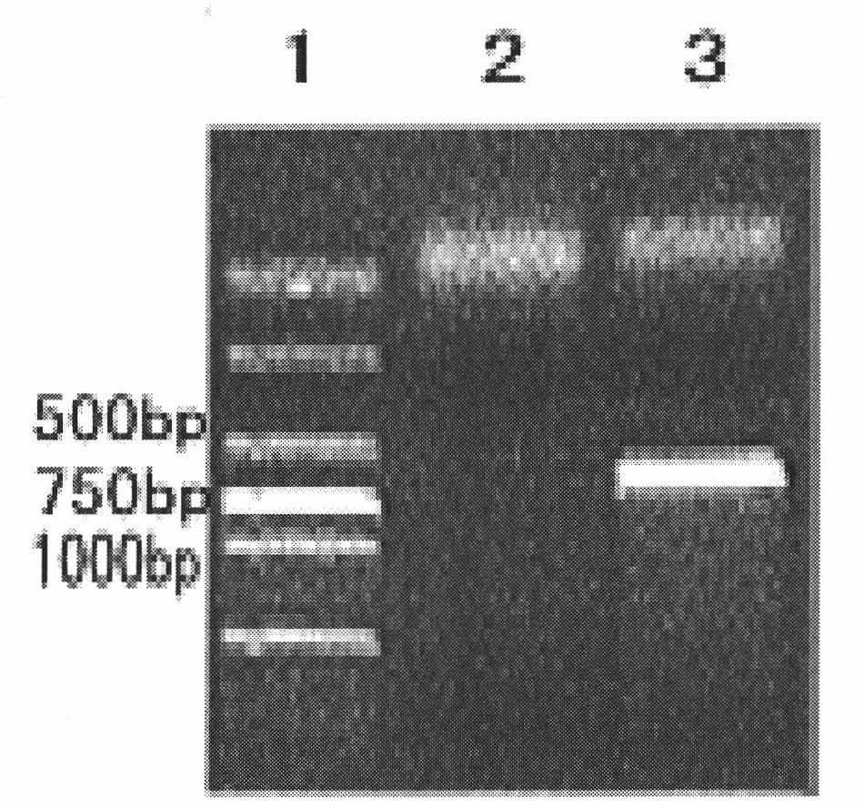 Double-antibody sandwich method for quickly detecting novel H1N1 influenza virus