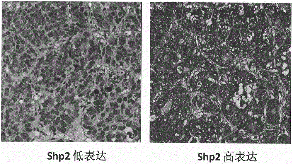 Application of Shp2 protein in preparation of kit for evaluating therapeutic effect of sorafenib on liver cancer