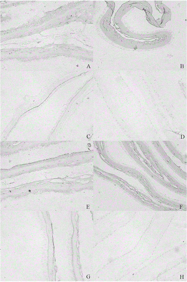 A biofilm for eye surface repair and its preparation method