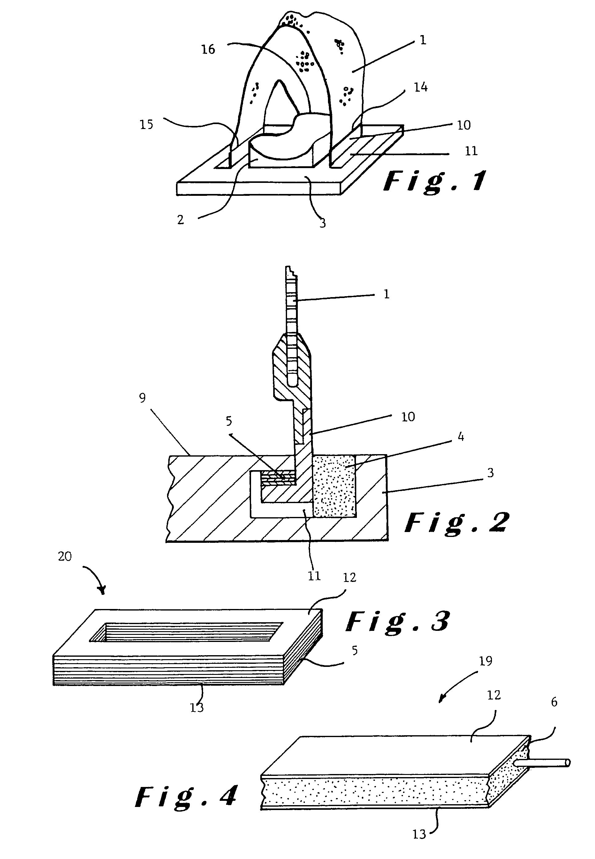 Head immobilisation assembly for patient positioning in radiation therapy