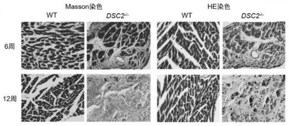 Construction method and application of DSC2 gene knockout mouse model