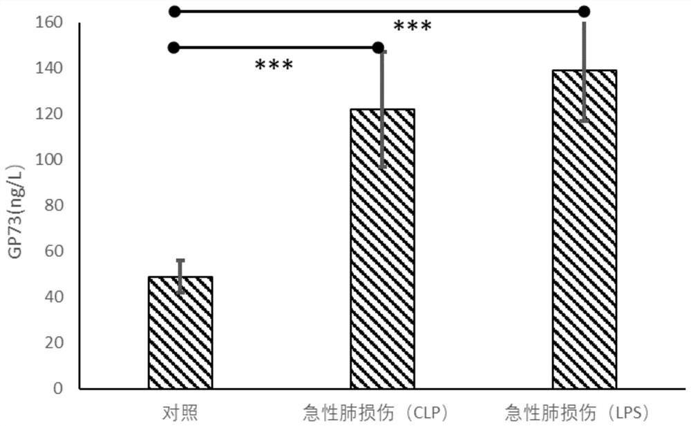 Application of apelin protein in preparation of reagents for diagnosing respiratory diseases