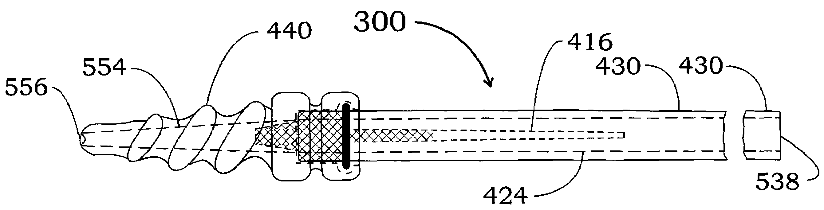 Method and apparatus for creating a pathway in an animal