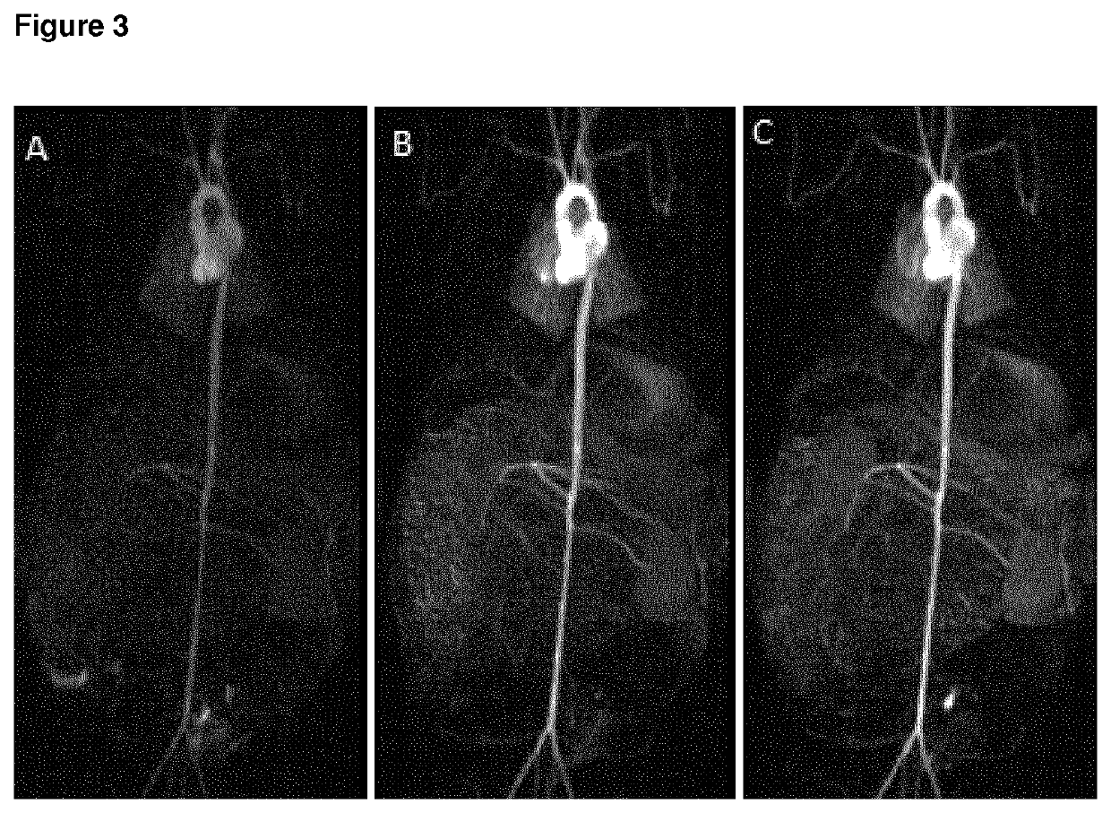 High relaxivity gadolinium chelate compounds for use in magnetic resonance imaging