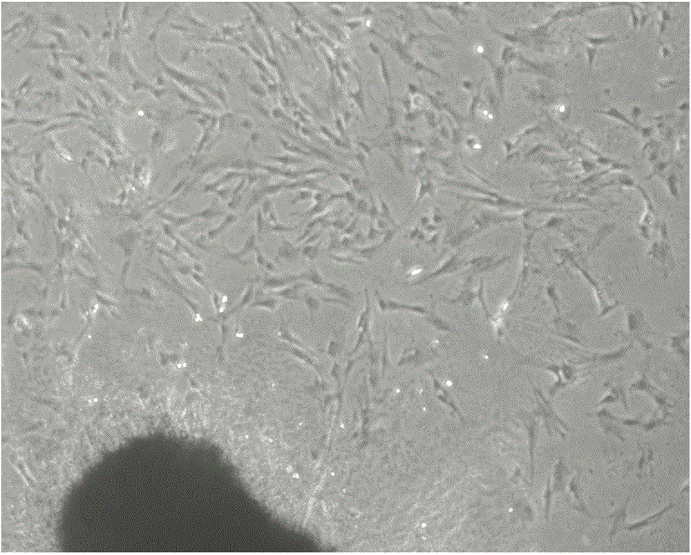 Method for rapidly obtaining and purifying human umbilical cord mesenchymal stem cells