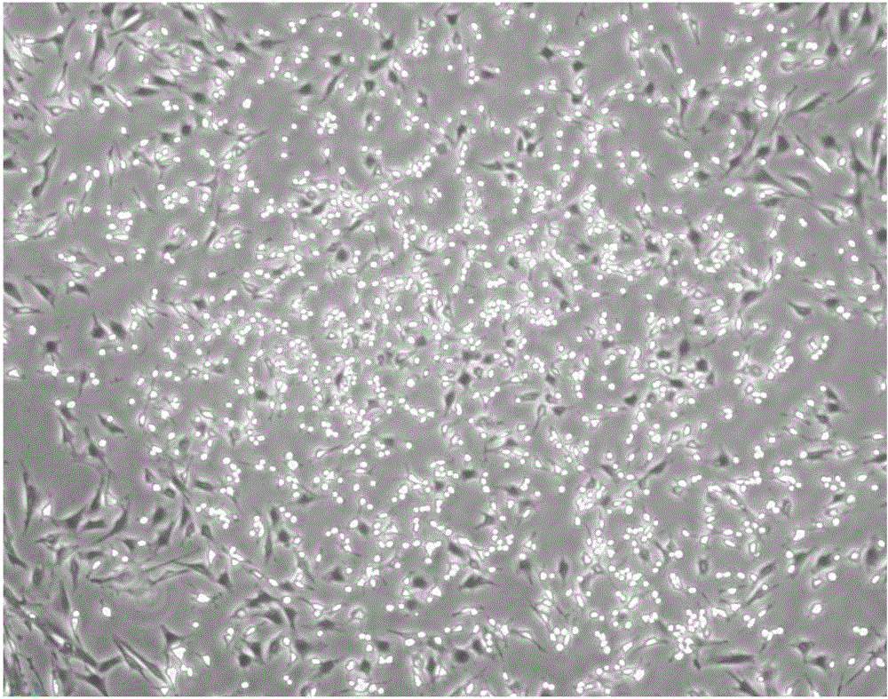 Method for rapidly obtaining and purifying human umbilical cord mesenchymal stem cells