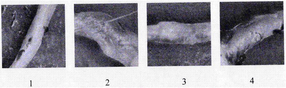 Pharmaceutical composition for treating atherosclerosis and application of pharmaceutical composition