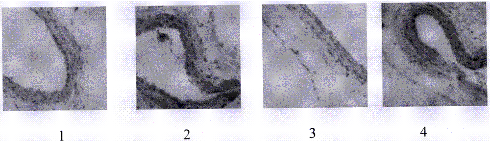 Pharmaceutical composition for treating atherosclerosis and application of pharmaceutical composition