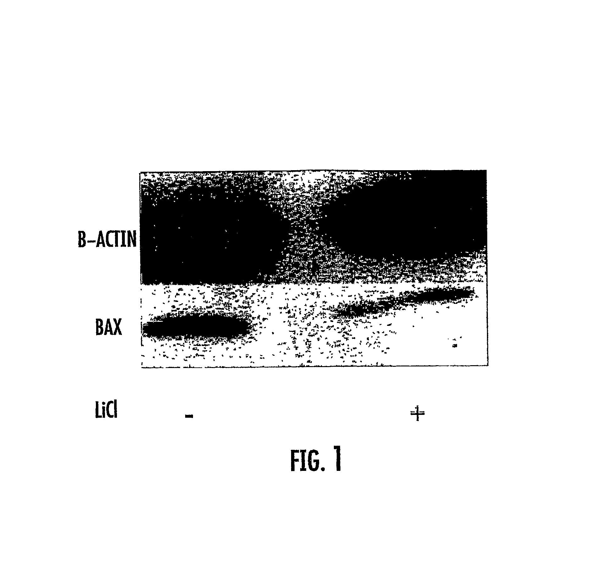 Use of GSK3 inhibitors in combination with radiation therapies