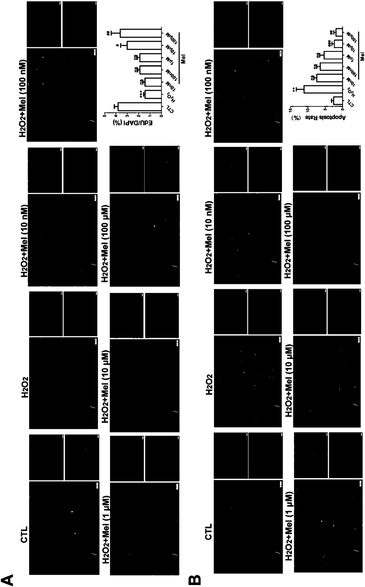 Application of melatonin in promotion of cardiac stem cell transplanting for treating myocardial infarction