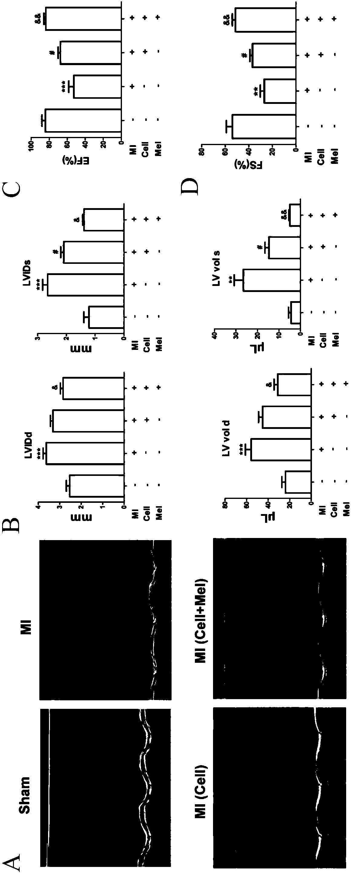 Application of melatonin in promotion of cardiac stem cell transplanting for treating myocardial infarction