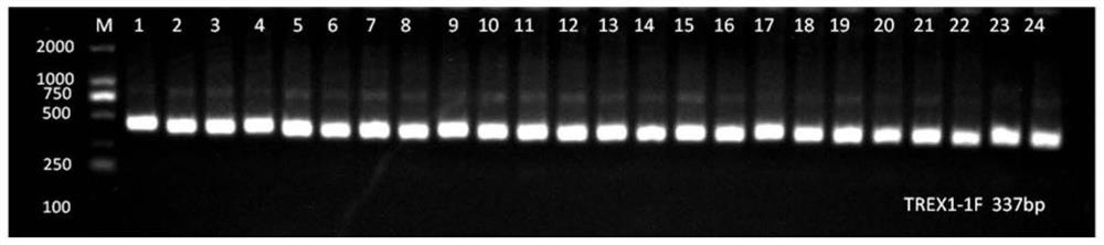 Primers, kit and method for detecting TREX1 gene mutation