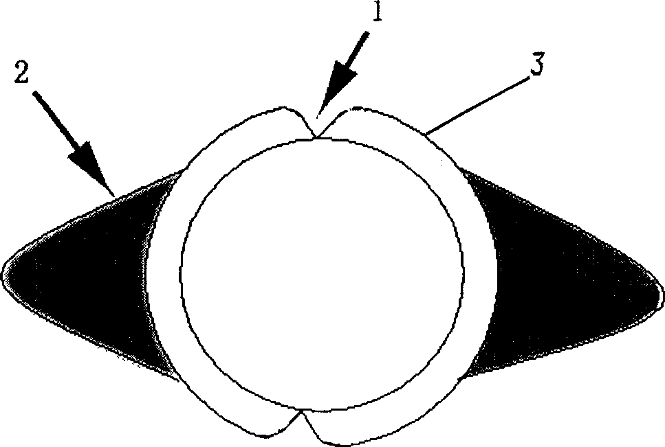 Gastric canal