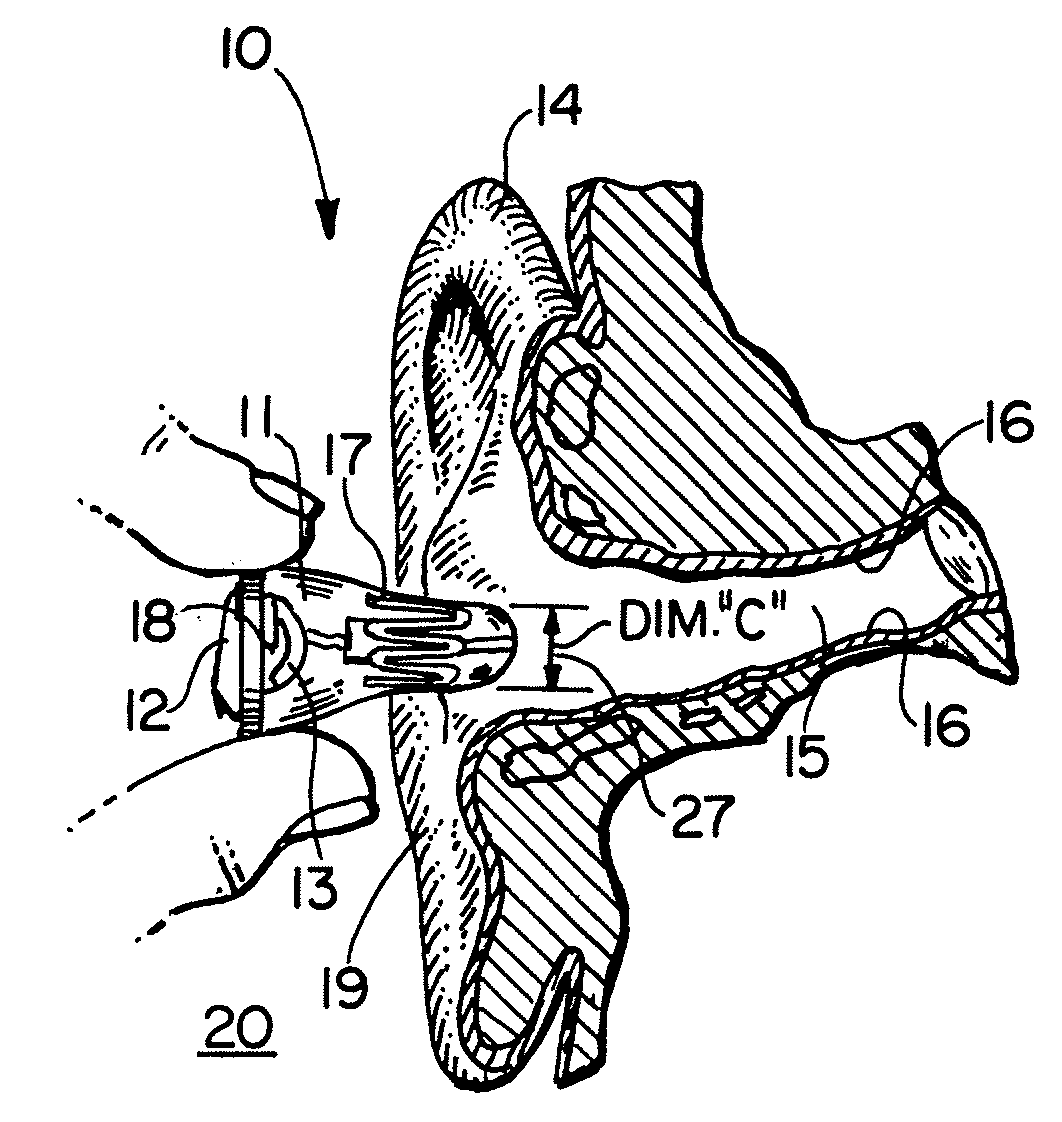 Self forming in-the-ear hearing aid with conical stent