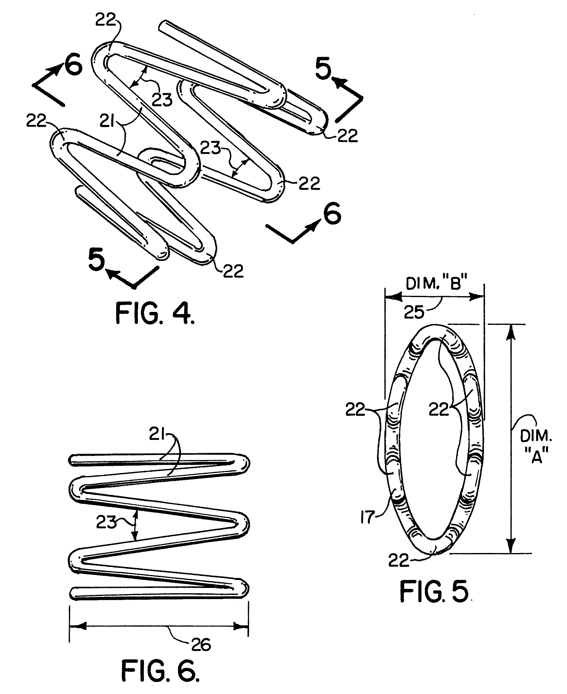 Self forming in-the-ear hearing aid with conical stent