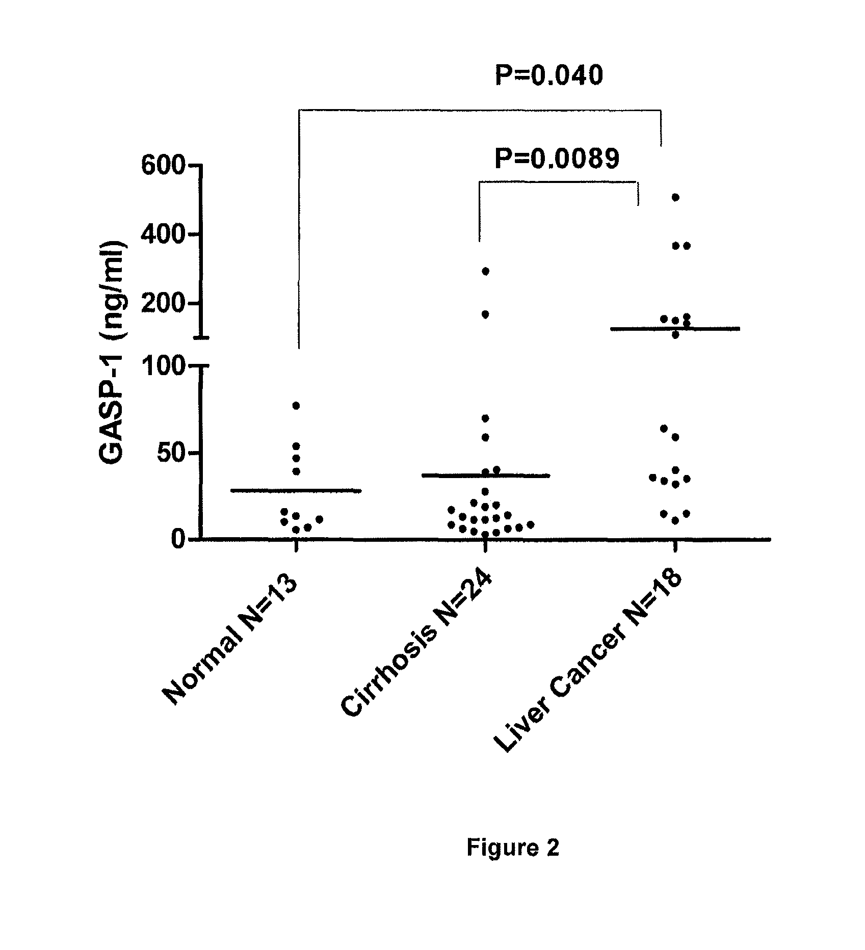 G-protein coupled receptor-associated sorting protein 1 as a cancer biomarker