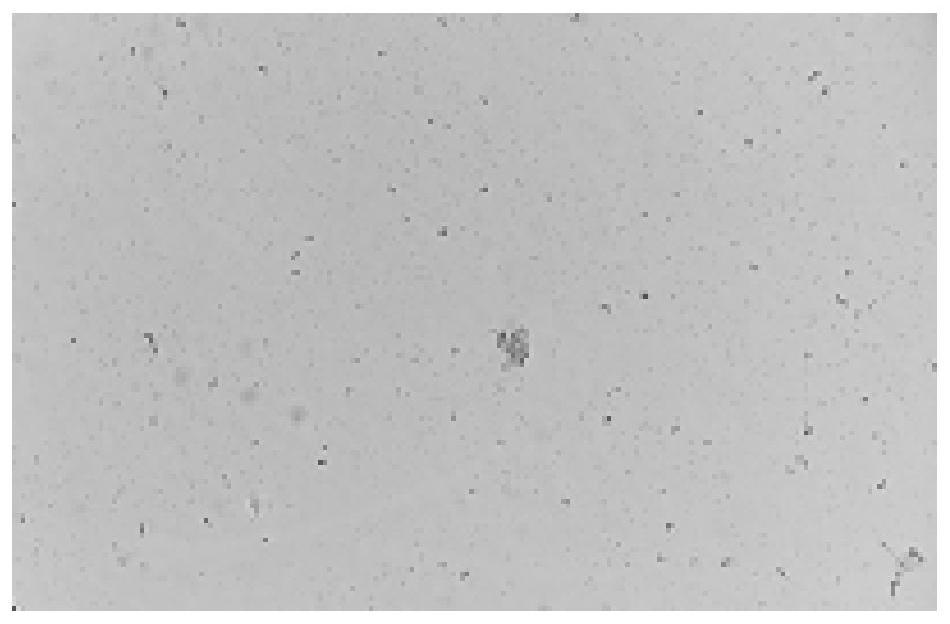 Malolactic fermentation (MLF) lactic acid bacteria strain with high yield of esterase and application thereof